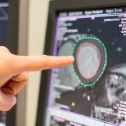 Imaging cardiovascolare